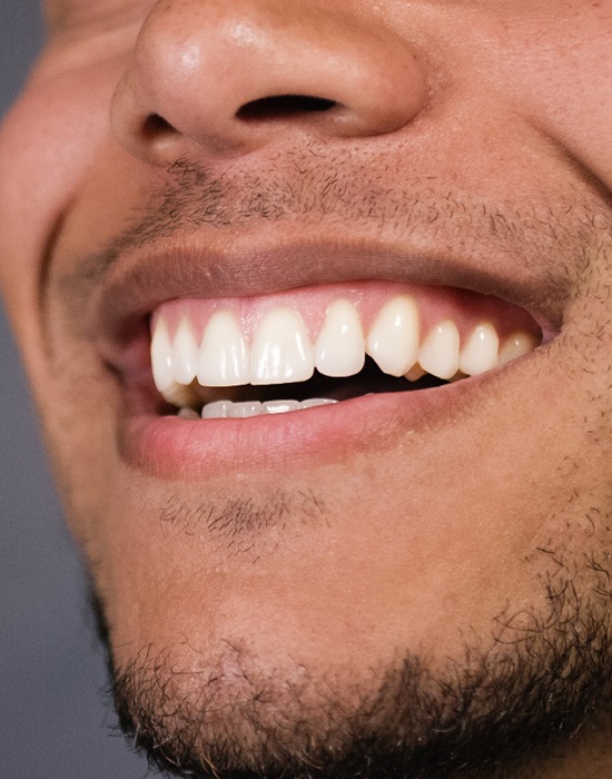Closeup of a man’s smile