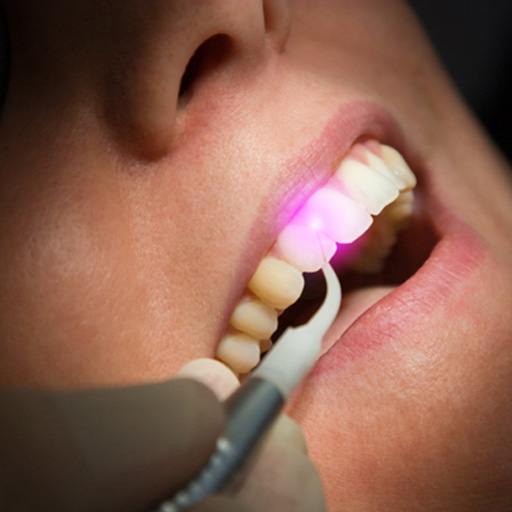 Patient receiving laser dentistry in Fort Worth 