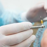surgery for cost of dental implants in Fort Worth