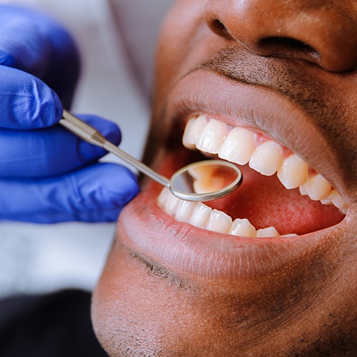 Dentist examining smile after tooth colored filling restoration