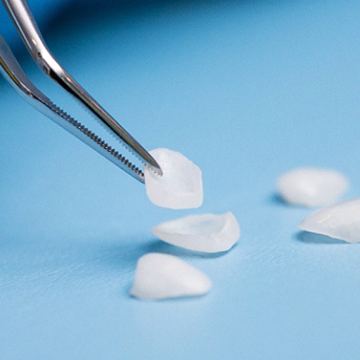 Closeup of Fort Worth cosmetic dentist holding veneers on a blue background