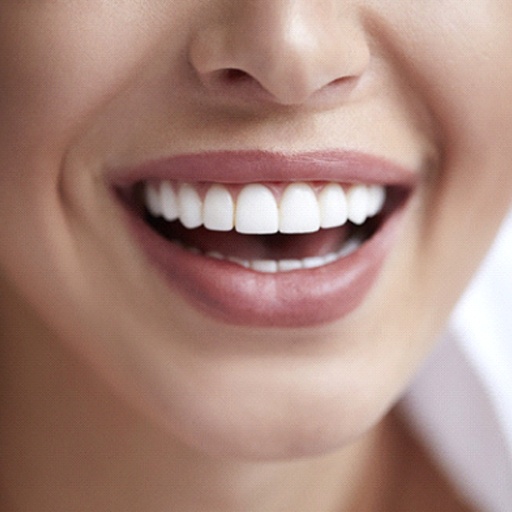 Closeup of smiling woman with beautiful dental veneers in Fort Worth