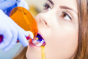 woman undergoing dental bonding