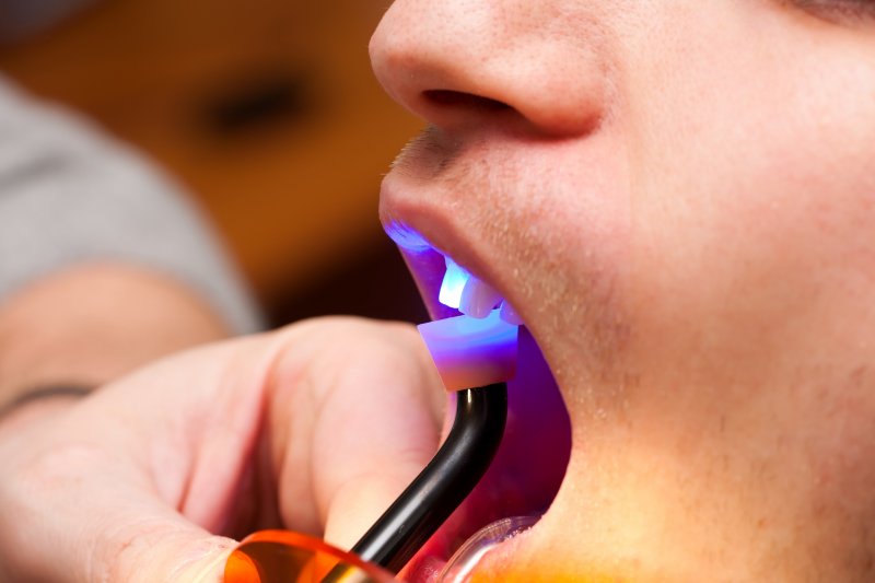 A closeup of a patient getting a dental bonding treatment