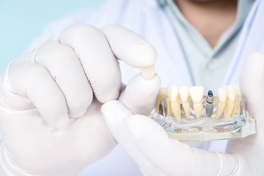 Dentist in white coat and gloves showing sample dental implant and crown