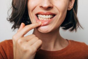 Woman pulling down bottom lip to show off gums. 