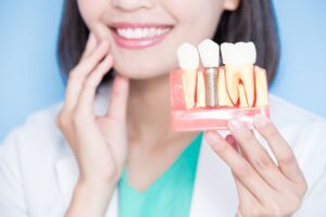 Dentist holding sample implant and touching her own cheek